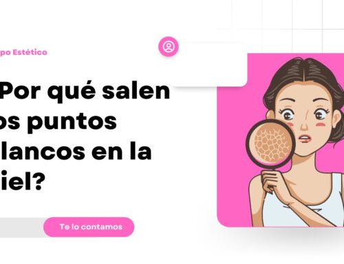 ¿Por qué tengo puntos blancos en la piel? Causas y soluciones efectivas