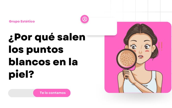 Por qué tengo puntos blancos en la piel